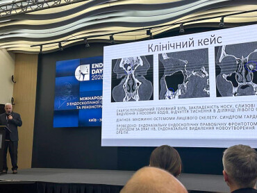 Викладач ПДМУ долучився до Міжнародного конгресу EndoDays 2026 з отоларингології та реконструктивної хірургії