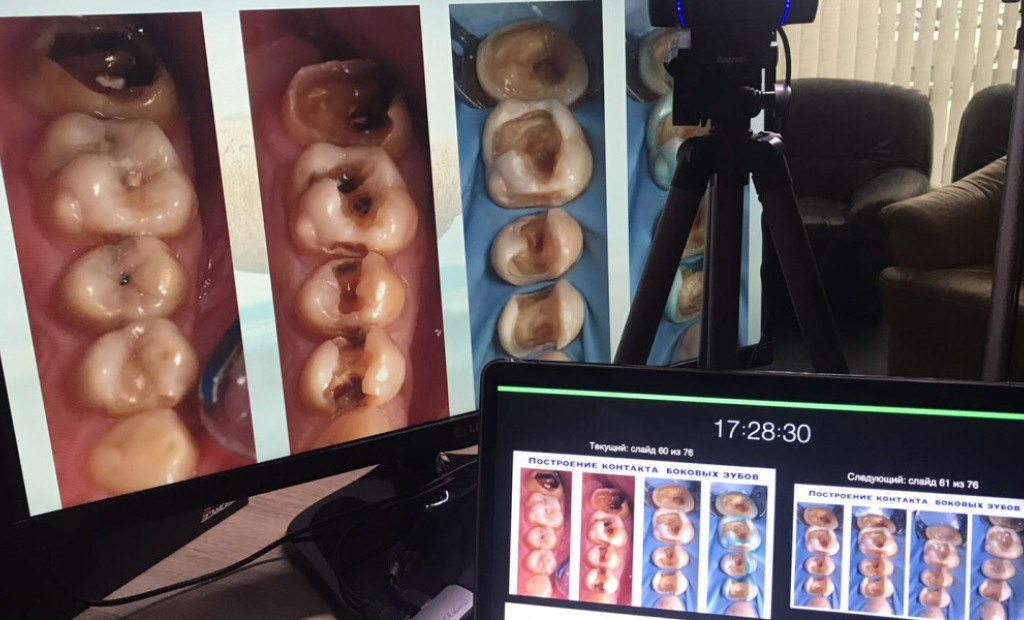 Онлайн вебінар лікарів-стоматологів