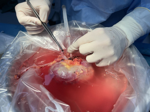 Відгук учасниці програми Erasmus+ Теницької Єлизавети