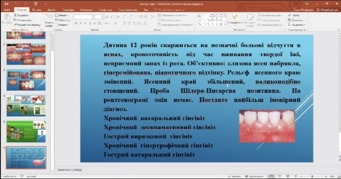 Підготовка до ліцензійного іспиту «Крок 2»