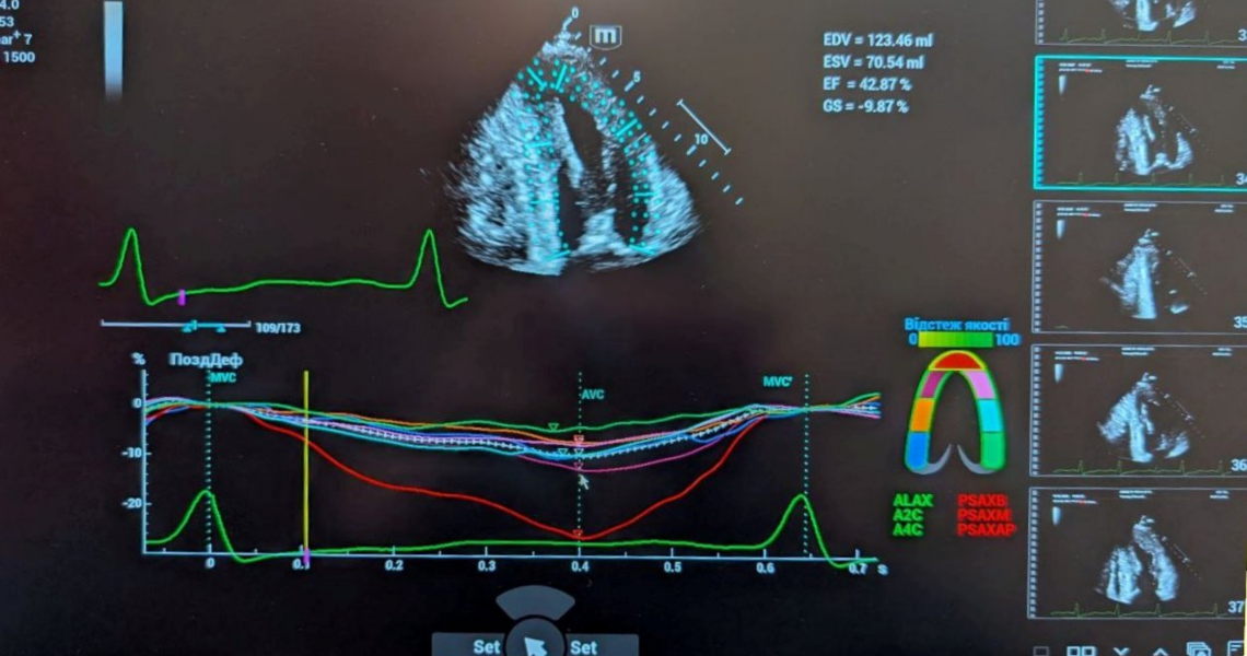 Майстер-клас з новітніх діагностичних технологій на кафедрі пропедевтики внутрішньої медицини