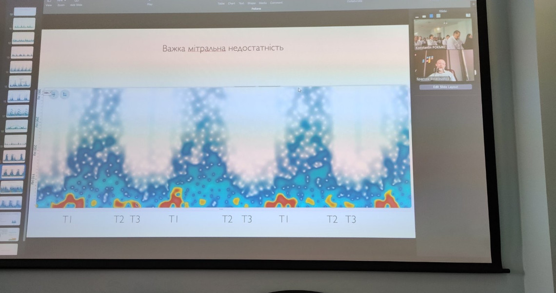 Використання технології «Стетофон» у повсякденній клінічній практиці: студенти вивчають / Stethophone technology in everyday clinical practice: students to be introduced