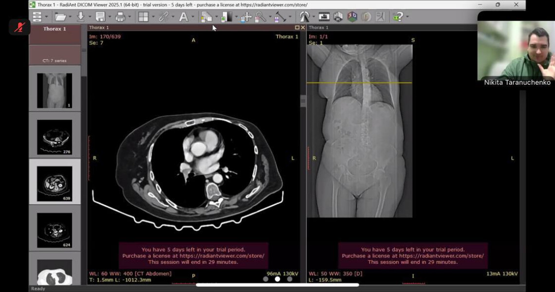 У ПДМУ відбулася онлайн-лекція «Кисневі мандри: судинне турне» / Online Lecture “Oxygen Journeys: A Vascular Tour” Held at PSMU