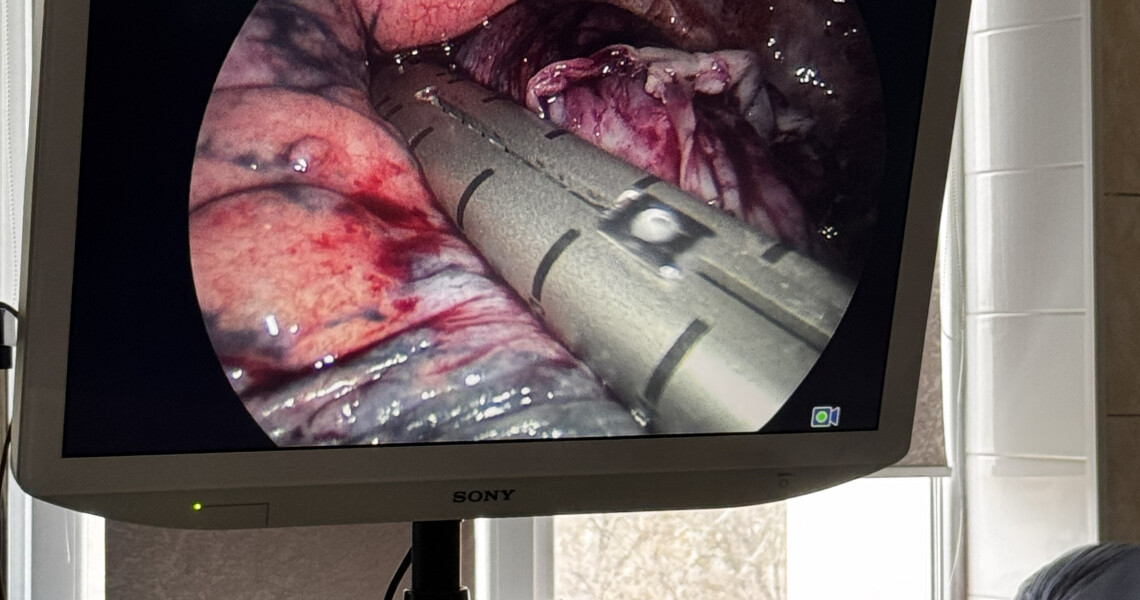 Майстер-клас із відеоасистованої торакоскопічної хірургії в ПДМУ: новий етап міжуніверситетської співпраці