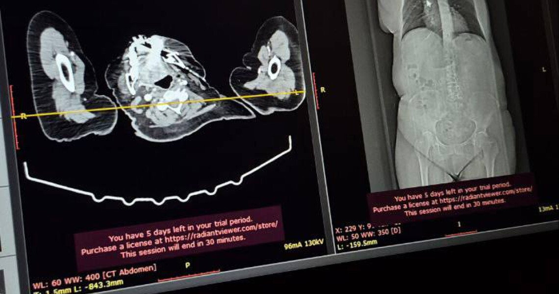 У ПДМУ відбулася онлайн-лекція «Кисневі мандри: судинне турне» / Online Lecture “Oxygen Journeys: A Vascular Tour” Held at PSMU