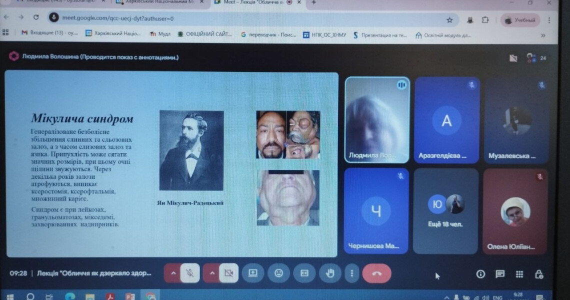 У ПДМУ відбулася лекція про щелепно-лицеві прояви ендокринних і серцево-судинних захворювань для слухачів ХНМУ