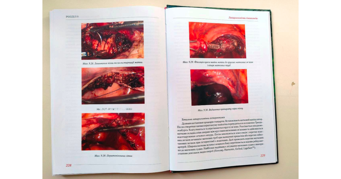 На допомогу хірургам: на кафедрі хірургії № 1 виданий новий навчальний посібник