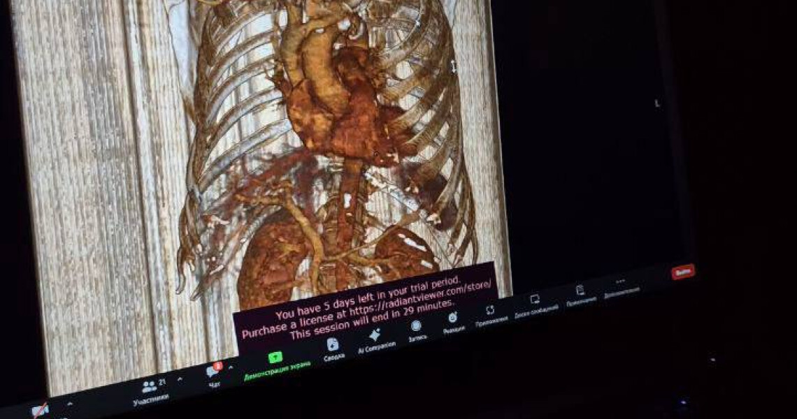 У ПДМУ відбулася онлайн-лекція «Кисневі мандри: судинне турне» / Online Lecture “Oxygen Journeys: A Vascular Tour” Held at PSMU