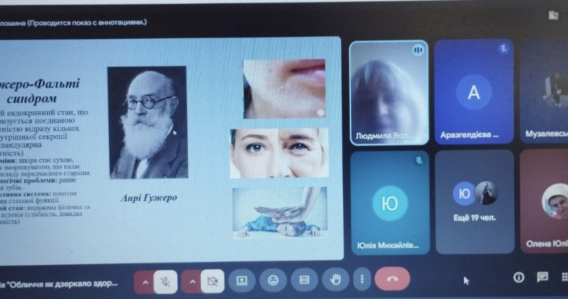 У ПДМУ відбулася лекція про щелепно-лицеві прояви ендокринних і серцево-судинних захворювань для слухачів ХНМУ