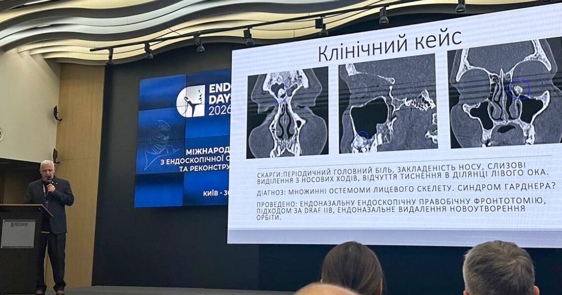 Викладач ПДМУ долучився до Міжнародного конгресу EndoDays 2026 з отоларингології та реконструктивної хірургії