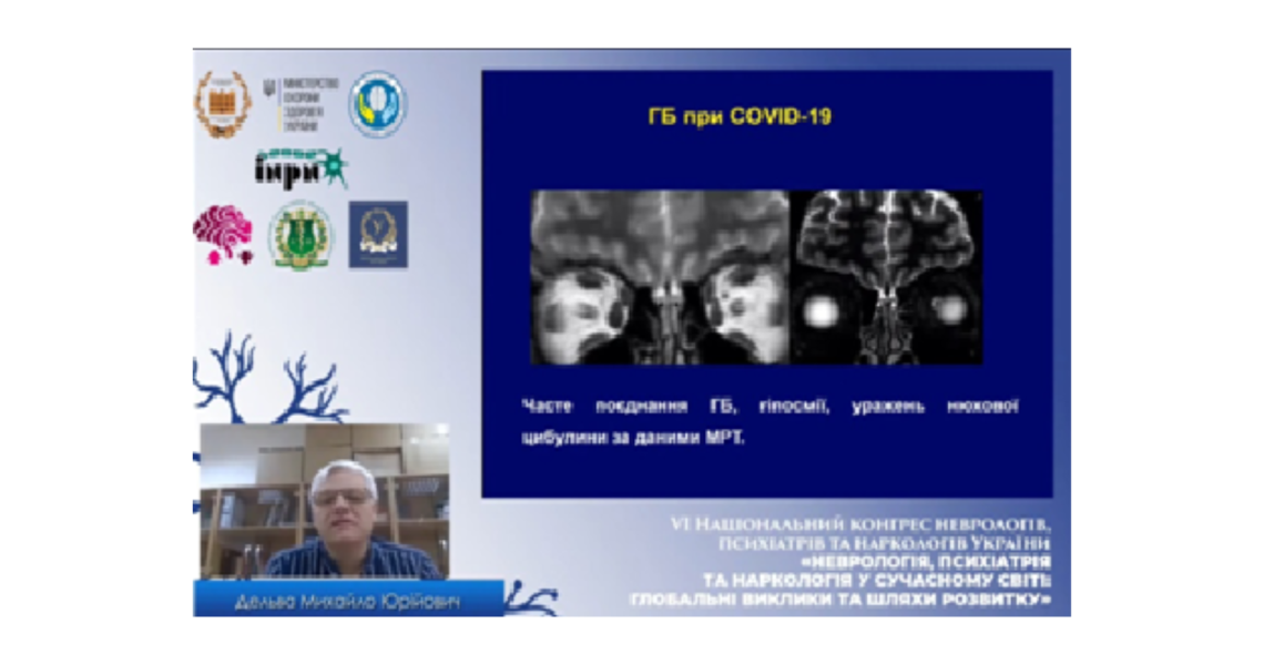 На VI Міжнародному конгресі неврологів, психіатрів та наркологів України неврологів Полтавщини представляв професор ЗВО ПДМУ