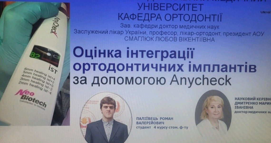 Ортодонтія – сила і гордість стоматології: у ПДМУ відзначили Міжнародний день ортодонта засіданням студентської наукової групи